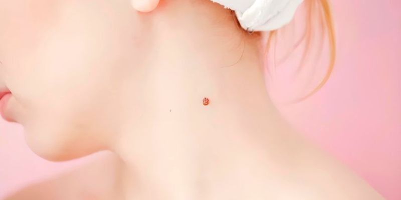 Vị trí và ý nghĩa nốt ruồi son